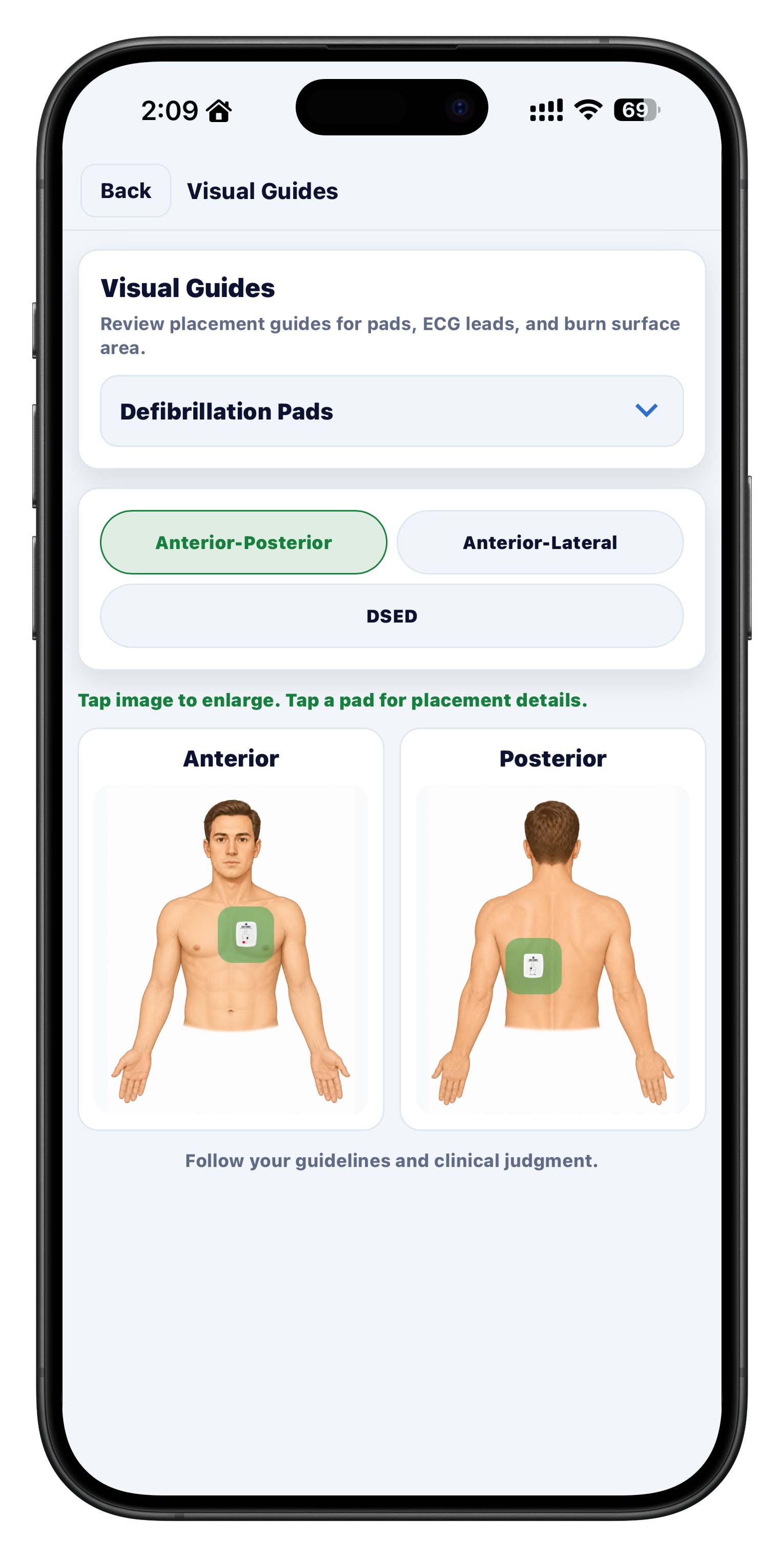 Visual Guides screen in the iOS app